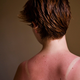 Image for article titled Sun Keeps Damaging Skin Cells For Hours After Exposure